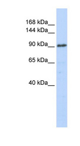 GTF3C3 antibody LS-C110337 Western blot of 721_B cell lysate.