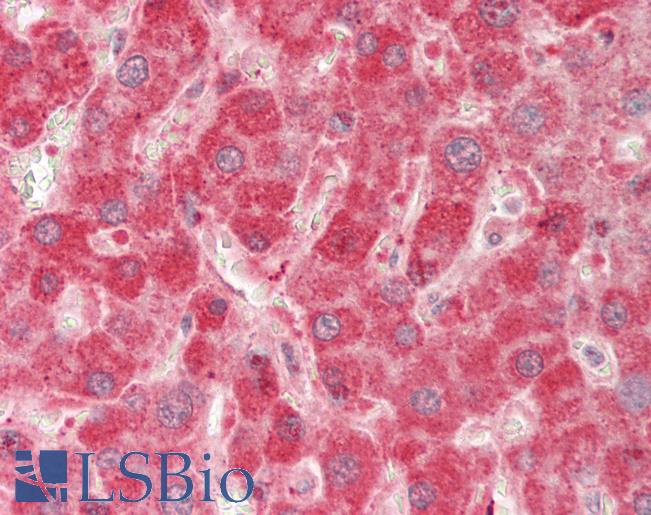 Human Liver: Formalin-Fixed, Paraffin-Embedded (FFPE)