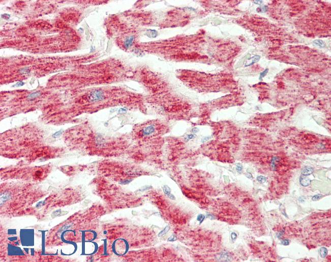 Human Heart: Formalin-Fixed, Paraffin-Embedded (FFPE)