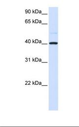 293T whole cell lysate. Anti-GOT2 Antibody concentration: 1.0 ug/ml.