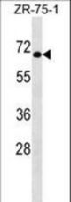 GTF3C5 Antibody western blot of ZR-75-1 cell line lysates (35 ug/lane). The GTF3C5 antibody detected the GTF3C5 protein (arrow).