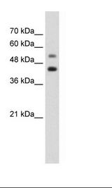 Jurkat Cell Lysate