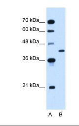 Lane A: Marker. Lane B: HepG2 cell lysate. Antibody concentration: 2.5 ug/ml. Gel concentration: 12%.