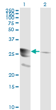 Western blot of GCH1 expression in transfected 293T cell line by GCH1 monoclonal antibody (M01), clone 4A12.