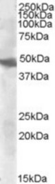 Antibody (0.3 ug/ml) staining of Human Liver cell lysate (35 ug protein in RIPA buffer). Primary incubation was 1 hour. Detected by chemiluminescence.