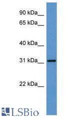 GTPCH1 / GCH1 antibody Western Blot of Fetal Heart. Antibody dilution: 1 ug/ml.