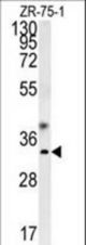 GCH1 Antibody western blot of ZR-75-1 cell line lysates (35 ug/lane). The GCH1 antibody detected the GCH1 protein (arrow).