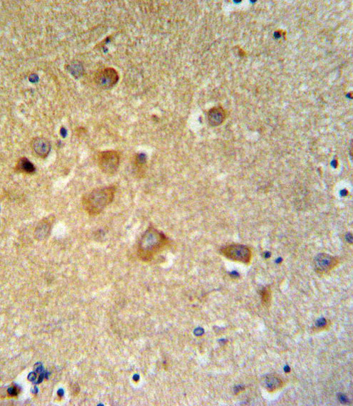 GTSE1 Antibody IHC of formalin-fixed and paraffin-embedded brain tissue followed by peroxidase-conjugated secondary antibody and DAB staining.