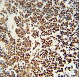 GTSF1 antibody immunohistochemistry of formalin-fixed and paraffin-embedded human lymph tissue followed by peroxidase-conjugated secondary antibody and DAB staining.