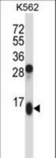 GUCA2A Antibody western blot of K562 cell line lysates (35 ug/lane). The GUCA2A antibody detected the GUCA2A protein (arrow).