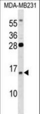 GUCA2B Antibody western blot of MDA-MB231 cell line lysates (35 ug/lane). The GUCA2B antibody detected the GUCA2B protein (arrow).