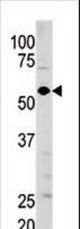 Western blot of anti-GUCY1A3 antibody in mouse brain tissue lysate (35 ug/lane). GUCY1A3(arrow) was detected using the purified antibody.