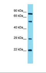 Western blot of Human HepG2. GUCY1A2 antibody dilution 1.0 ug/ml.