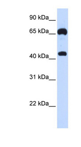 GUCY1B3 / Guanylyl Cyclase Beta 1 antibody LS-C102202 Western blot of 293T cell lysate.
