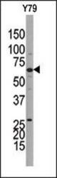 Western blot of anti-GUCY1B3 antibody in Y79 cell line lysate. GUCY1B3(arrow) was detected using the purified antibody.