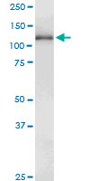 GUCY2D monoclonal antibody (M01), clone 4E12. Western Blot analysis of GUCY2D expression in human spleen.