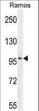 GUCY2D Antibody western blot of Ramos cell line lysates (35 ug/lane). The GUCY2D antibody detected the GUCY2D protein (arrow).