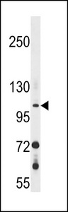 GUCY2F Antibody western blot of 293 cell line lysates (35 ug/lane). The GUCY2F antibody detected the GUCY2F protein (arrow).