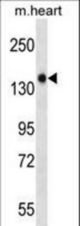 Mouse Gucy2f Antibody western blot of mouse heart tissue lysates (35 ug/lane). The Gucy2f antibody detected the Gucy2f protein (arrow).