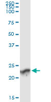 Immunoprecipitation of GUK1 transfected lysate using anti-GUK1 monoclonal antibody and Protein A Magnetic Bead, and immunoblotted with GUK1 rabbit polyclonal antibody.