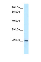 GUK1 antibody LS-C145647 Western blot of Rat Muscle lysate. Antibody concentration 1 ug/ml.