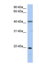 GUK1 antibody LS-C111554 Western blot of Fetal Kidney lysate.