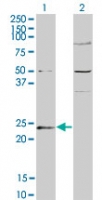 Western blot of GUK1 in 1) transfected 293T cells and 2) untransfected 293T cells using LS-C147987 at 1:500.