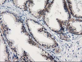 IHC of paraffin-embedded Human prostate tissue using anti-GUK1 mouse monoclonal antibody. (Heat-induced epitope retrieval by 10mM citric buffer, pH6.0, 100C for 10min).