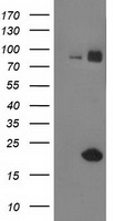 HEK293T cells were transfected with the pCMV6-ENTRY control (Left lane) or pCMV6-ENTRY GUK1 (Right lane) cDNA for 48 hrs and lysed. Equivalent amounts of cell lysates (5 ug per lane) were separated by SDS-PAGE and immunoblotted with anti-GUK1.