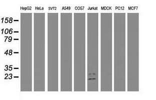 Western blot of extracts (35 ug) from 9 different cell lines by using anti-GUK1 monoclonal antibody.