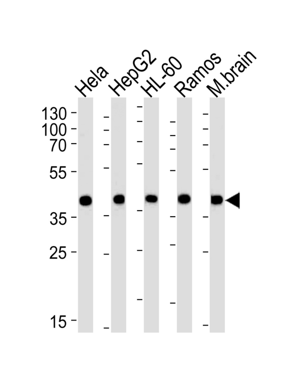 Western blot of lysates from HeLa, HepG2, HL-60, Ramos, mouse brain cell line (from left to right), using GOT2 Antibody. Antibody was diluted at 1:1000 at each lane. A goat anti-rabbit IgG H&L (HRP) at 1:5000 dilution was used as the secondary antibody. Lysates at 35ug per lane.