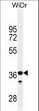 GLT8D3 Antibody western blot of WiDr cell line lysates (35 ug/lane). The GLT8D3 antibody detected the GLT8D3 protein (arrow).