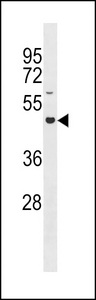 GLT8D4 Antibody western blot of SK-BR-3 cell line lysates (35 ug/lane). The GLT8D4 antibody detected the GLT8D4 protein (arrow).
