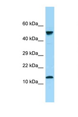 GYPA / Glycophorin A antibody LS-C146546 Western blot of Fetal Kidney lysate. Antibody concentration 1 ug/ml.