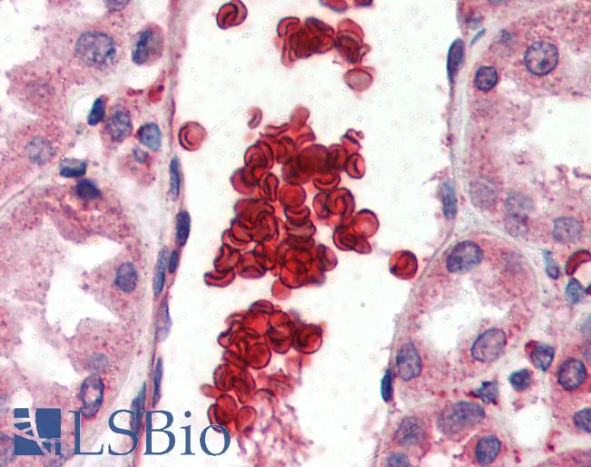Anti-GYPA / Glycophorin A antibody IHC of human red blood cells. Immunohistochemistry of formalin-fixed, paraffin-embedded tissue after heat-induced antigen retrieval. Antibody LS-B3010 concentration 2 ug/ml.