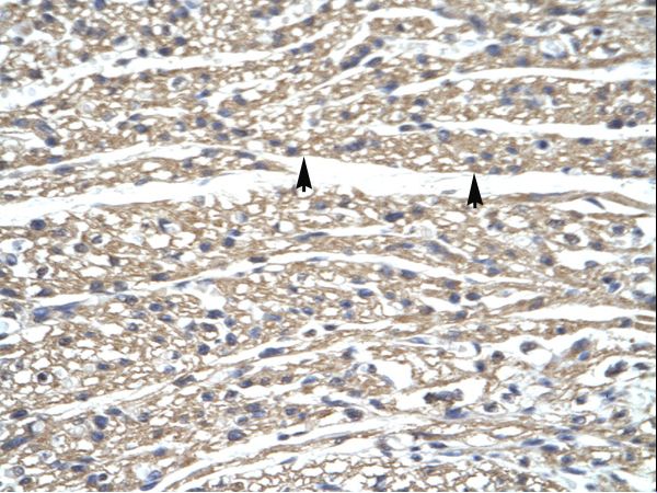GZF1 / ZNF336 antibody LS-C29779 was used in IHC to stain formalin-fixed, paraffin-embedded human heart.