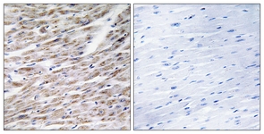 IHC of paraffin-embedded human heart tissue, using GRAA Antibody. The sample on the right was incubated with synthetic peptide.