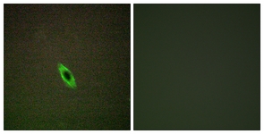 Immunofluorescence of HepG2 cells, using GRAA Antibody. The sample on the right was incubated with synthetic peptide.