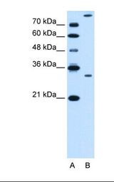 Lane A: Marker. Lane B: HepG2 cell lysate. Antibody concentration: 0.5 ug/ml. Gel concentration: 12%.