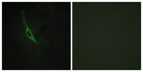 Immunofluorescence of NIH-3T3 cells, using GRAK Antibody. The picture on the right is treated with the synthesized peptide.