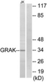 Western blot of extracts from Jurkat cells, using GRAK Antibody. The lane on the right is treated with the synthesized peptide.
