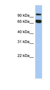 GGN antibody LS-C111470 Western blot of OVCAR-3 cell lysate.