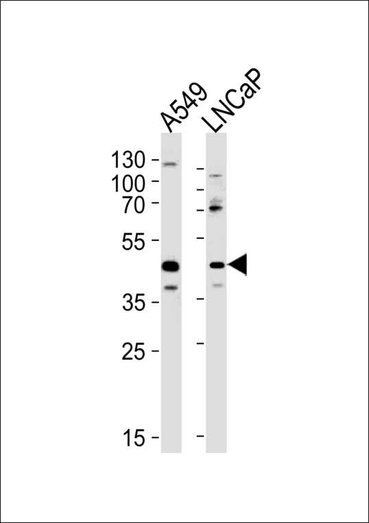 GGN Antibody western blot of A549, LNCaP cell line lysates (35 ug/lane). The GGN antibody detected the GGN protein (arrow).