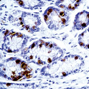 Formalin-fixed, paraffin-embedded human stomach stained with peroxidase-conjugate and DAB chromogen. Note cytoplasmic staining of gastrin-secreting cells.