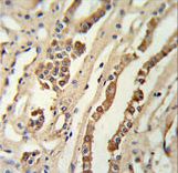 GMNN Antibody (Center Y111) IHC of formalin-fixed and paraffin-embedded lung tissue followed by peroxidase-conjugated secondary antibody and DAB staining. This data demonstrates the use of the GMNN Antibody (Center Y111) for immunohistochemistry.