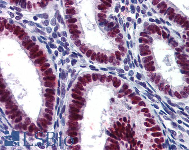 Anti-GMNN / Geminin antibody IHC of human uterus. Immunohistochemistry of formalin-fixed, paraffin-embedded tissue after heat-induced antigen retrieval. Antibody LS-B6226 concentration 1 ug/ml.