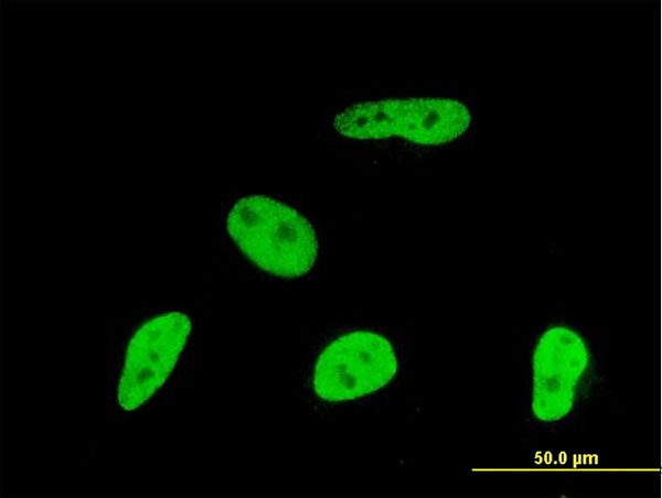Immunofluorescence of monoclonal antibody to GMNN on HeLa cell. [antibody concentration 10 ug/ml].