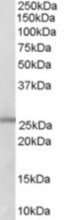 Antibody (0.3 ug/ml) staining of Human Lung lysate (35 ug protein in RIPA buffer). Primary incubation was 1 hour. Detected by chemiluminescence.