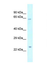 Gm216 antibody LS-C145714 Western blot of Mouse Pancreas lysate. Antibody concentration 1 ug/ml.