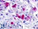 Anti-GNRHR antibody LS-A209 IHC of human pituitary. Immunohistochemistry of formalin-fixed, paraffin-embedded tissue after heat-induced antigen retrieval.